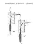 STENT GRAFT WITH INTEGRAL SIDE ARM diagram and image