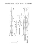 STENT GRAFT WITH INTEGRAL SIDE ARM diagram and image