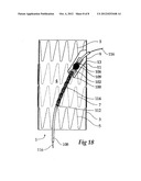 STENT GRAFT WITH INTEGRAL SIDE ARM diagram and image