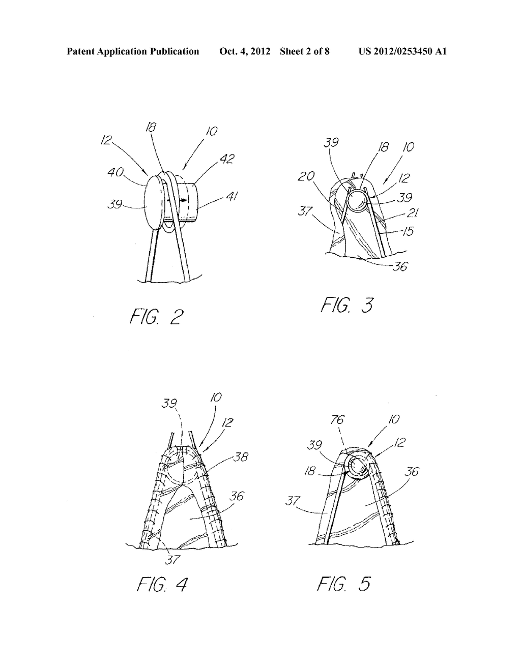 Prosthesis Adapted for Placement Under External Imaging - diagram, schematic, and image 03