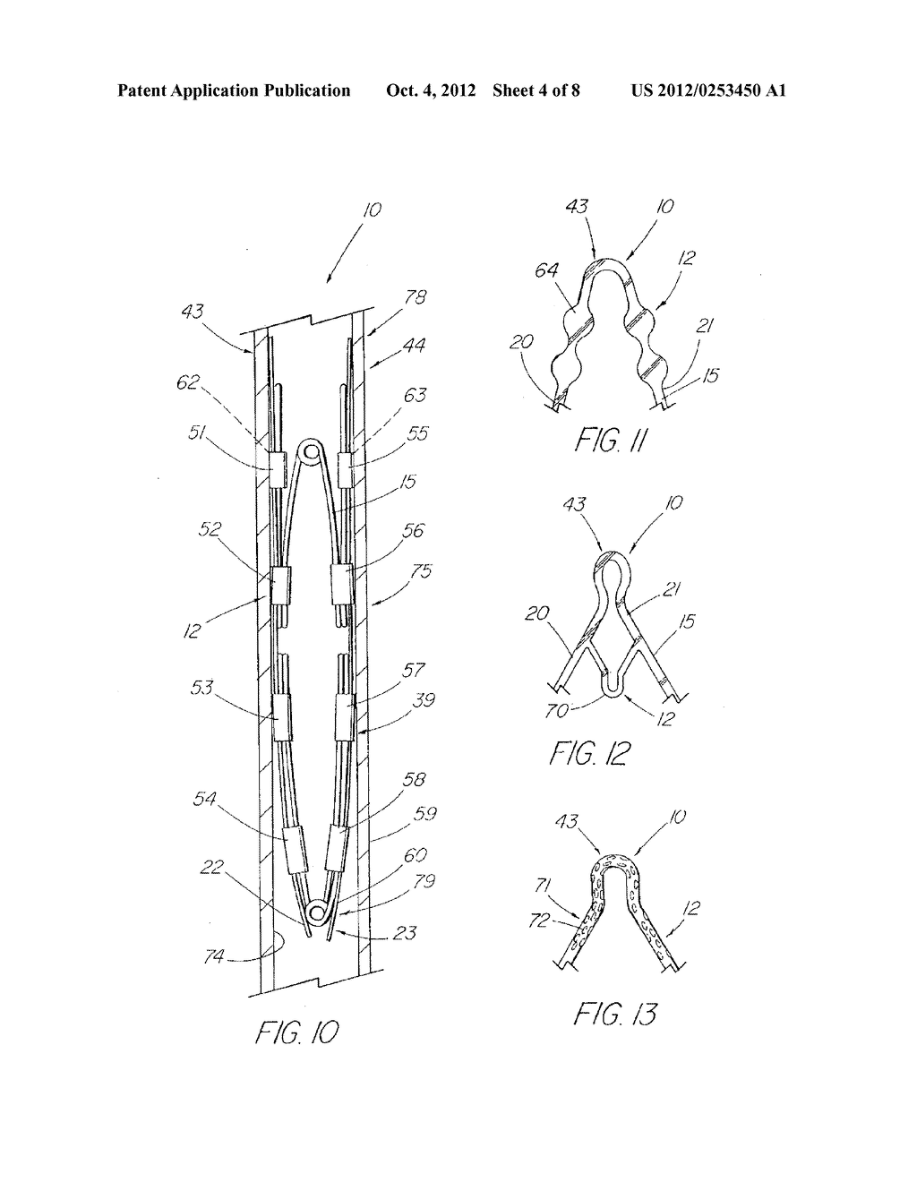 Prosthesis Adapted for Placement Under External Imaging - diagram, schematic, and image 05