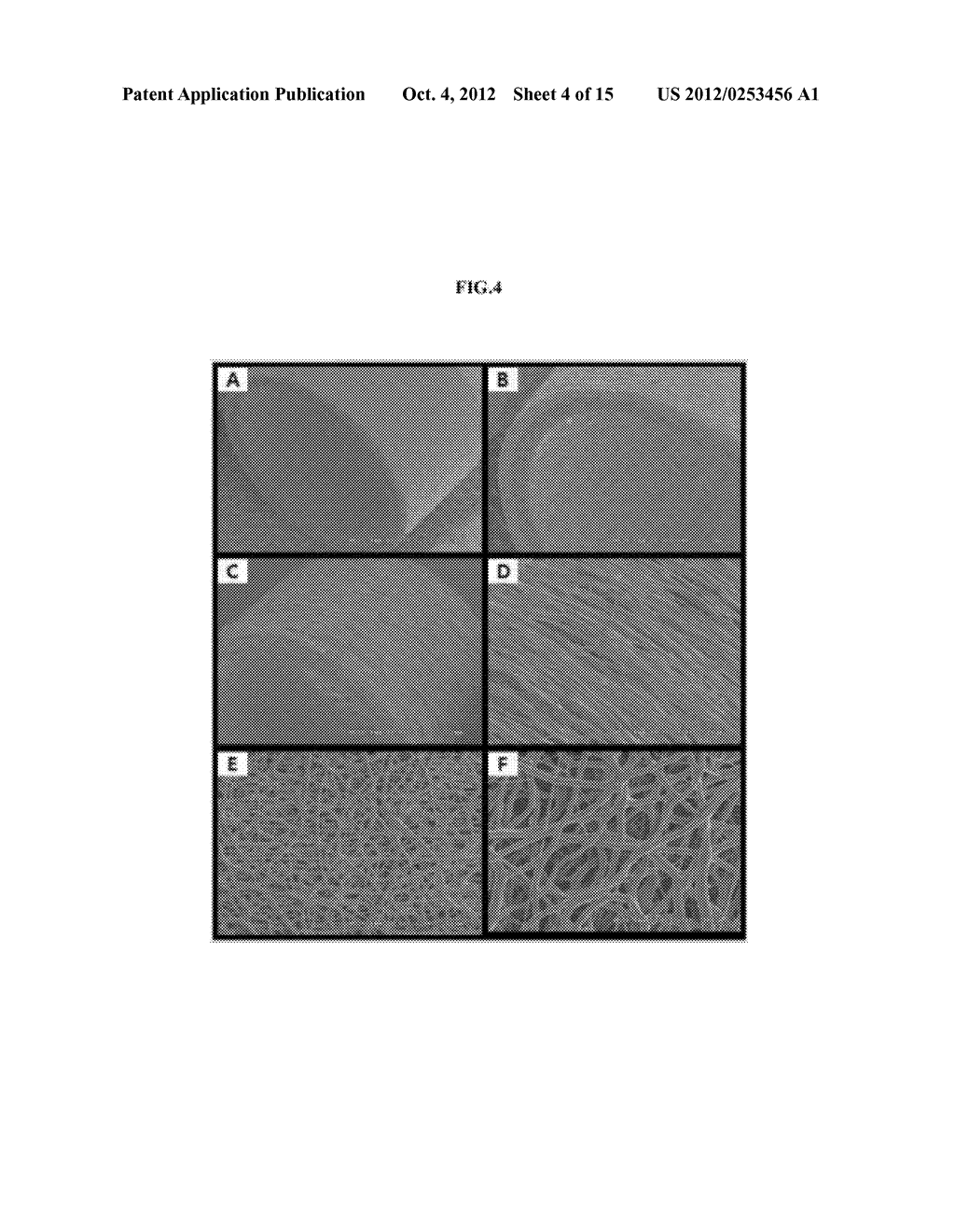 METHOD FOR PREPARATION OF ARTIFICIAL BLOOD VESSEL USING TUBE-TYPE POROUS     BIODEGRADABLE SCAFFOLD HAVING A DOUBLE-LAYERED STRUCTURE AND STEM CELL,     AND ARTIFICIAL BLOOD VESSEL MADE BY THE SAME - diagram, schematic, and image 05