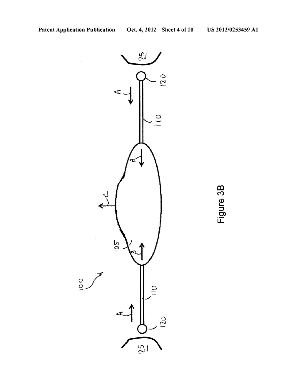 INTRAOCULAR ACCOMMODATING LENS AND METHODS OF USE - diagram, schematic, and image 05