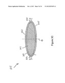 INTRAOCULAR ACCOMMODATING LENS AND METHODS OF USE diagram and image