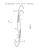 INTRAOCULAR ACCOMMODATING LENS AND METHODS OF USE diagram and image