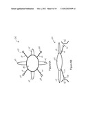 INTRAOCULAR ACCOMMODATING LENS AND METHODS OF USE diagram and image