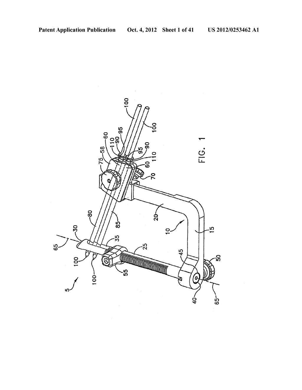 METHOD AND APPARATUS FOR FIXING A GRAFT IN A BONE TUNNEL - diagram, schematic, and image 02