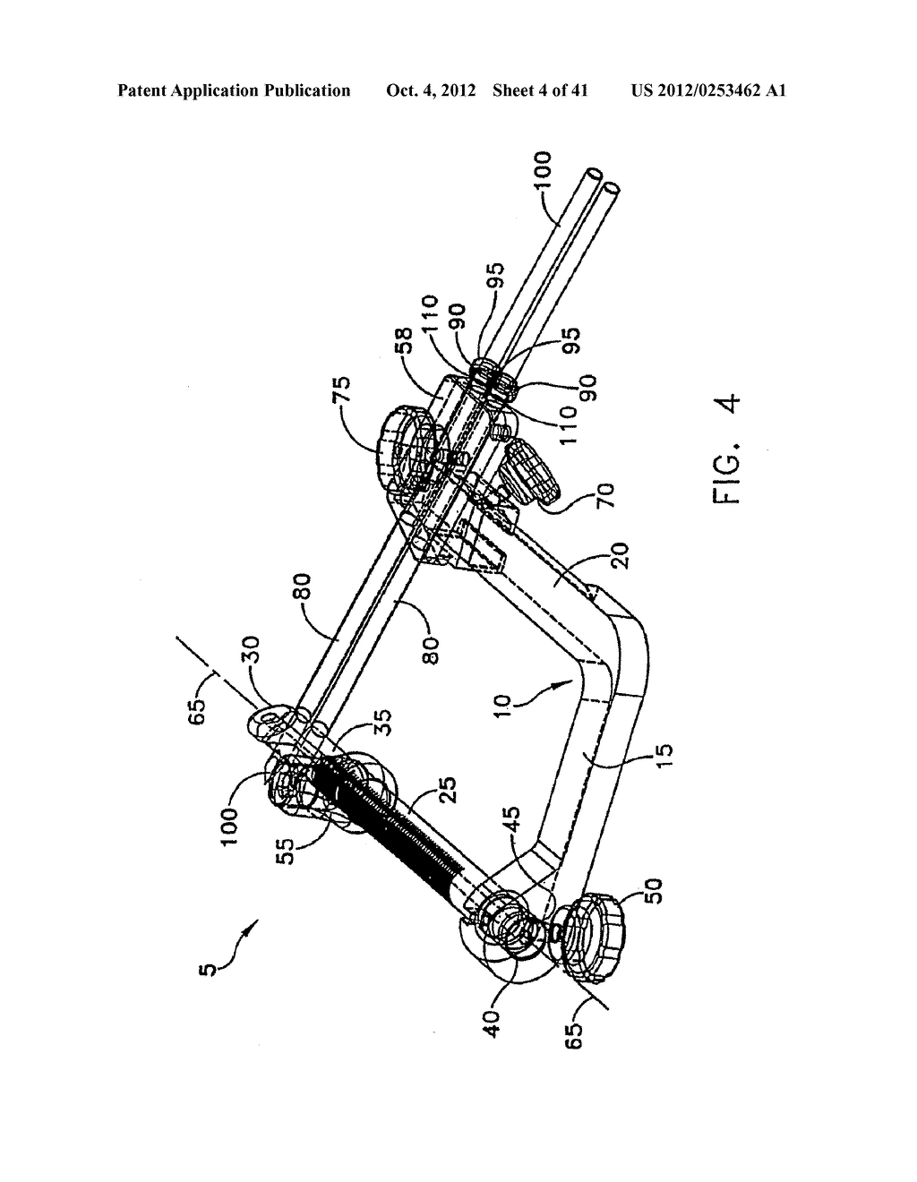 METHOD AND APPARATUS FOR FIXING A GRAFT IN A BONE TUNNEL - diagram, schematic, and image 05