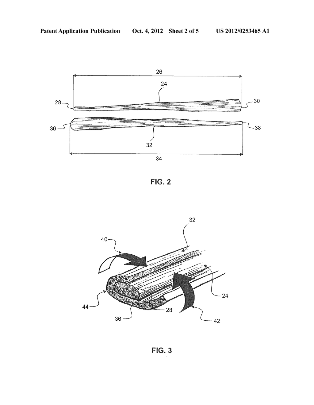 Dual Tendon Bundle - diagram, schematic, and image 03