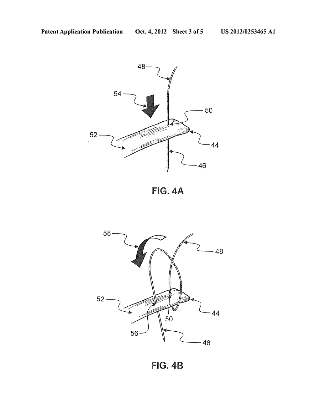 Dual Tendon Bundle - diagram, schematic, and image 04