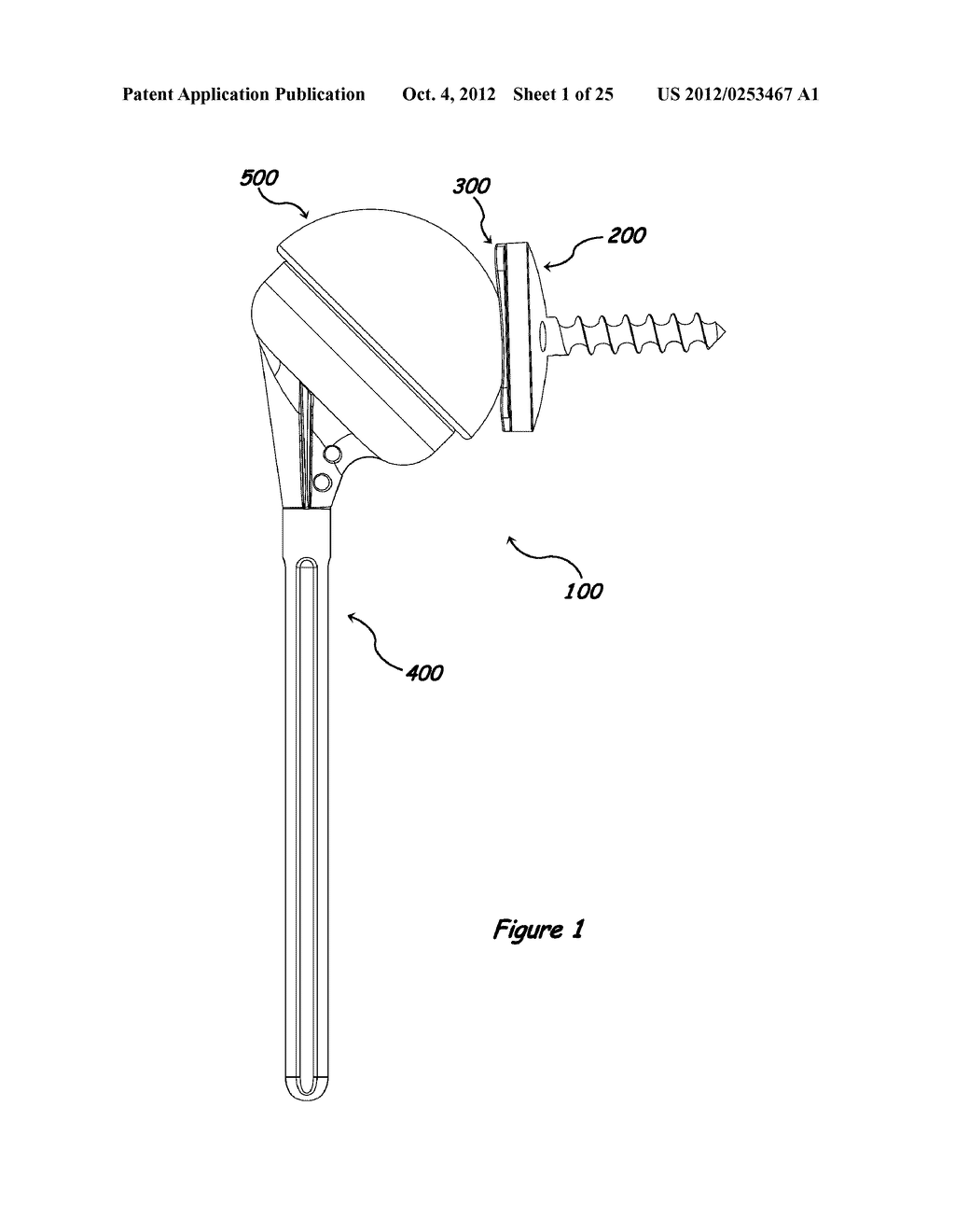 Shoulder Arthroplasty Systems and Configurations for Components Thereof - diagram, schematic, and image 02