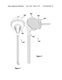 Shoulder Arthroplasty Systems and Configurations for Components Thereof diagram and image