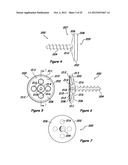 Shoulder Arthroplasty Systems and Configurations for Components Thereof diagram and image