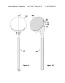 Shoulder Arthroplasty Systems and Configurations for Components Thereof diagram and image