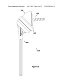 Shoulder Arthroplasty Systems and Configurations for Components Thereof diagram and image