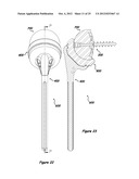 Shoulder Arthroplasty Systems and Configurations for Components Thereof diagram and image