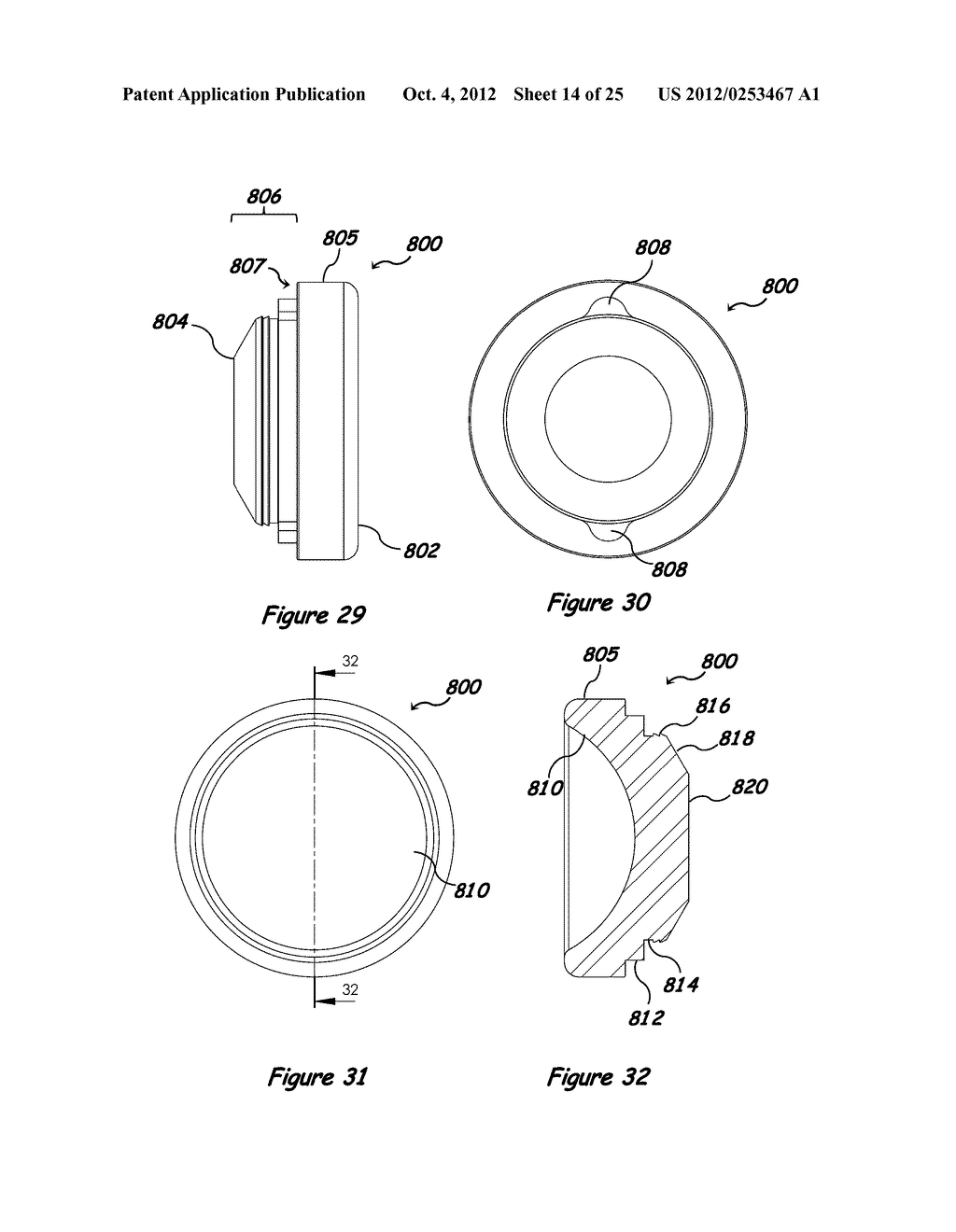 Shoulder Arthroplasty Systems and Configurations for Components Thereof - diagram, schematic, and image 15