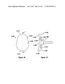 Shoulder Arthroplasty Systems and Configurations for Components Thereof diagram and image