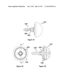 Shoulder Arthroplasty Systems and Configurations for Components Thereof diagram and image