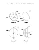 Shoulder Arthroplasty Systems and Configurations for Components Thereof diagram and image