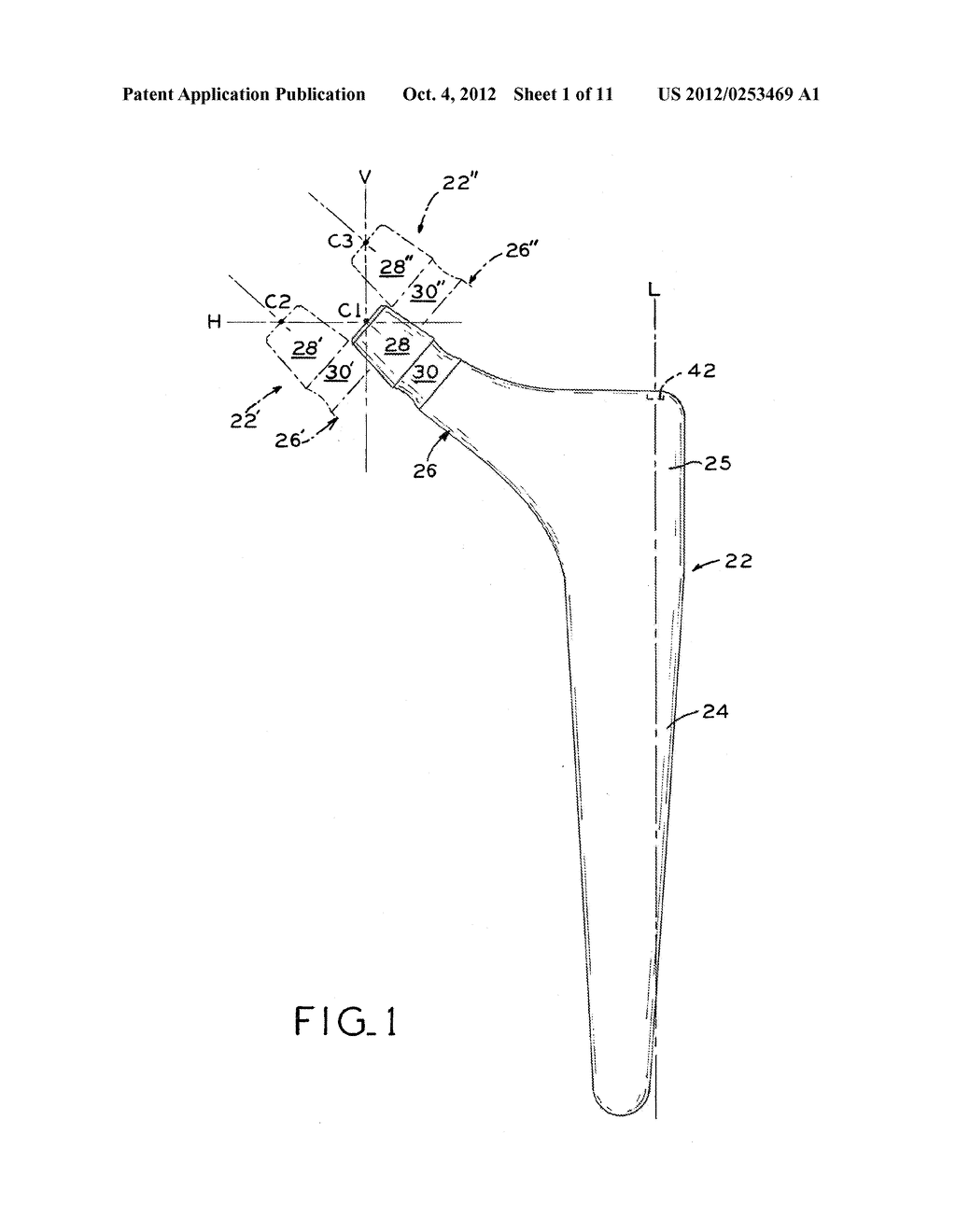 ORTHOPEDIC IMPLANT INSERTION INSTRUMENT - diagram, schematic, and image 02