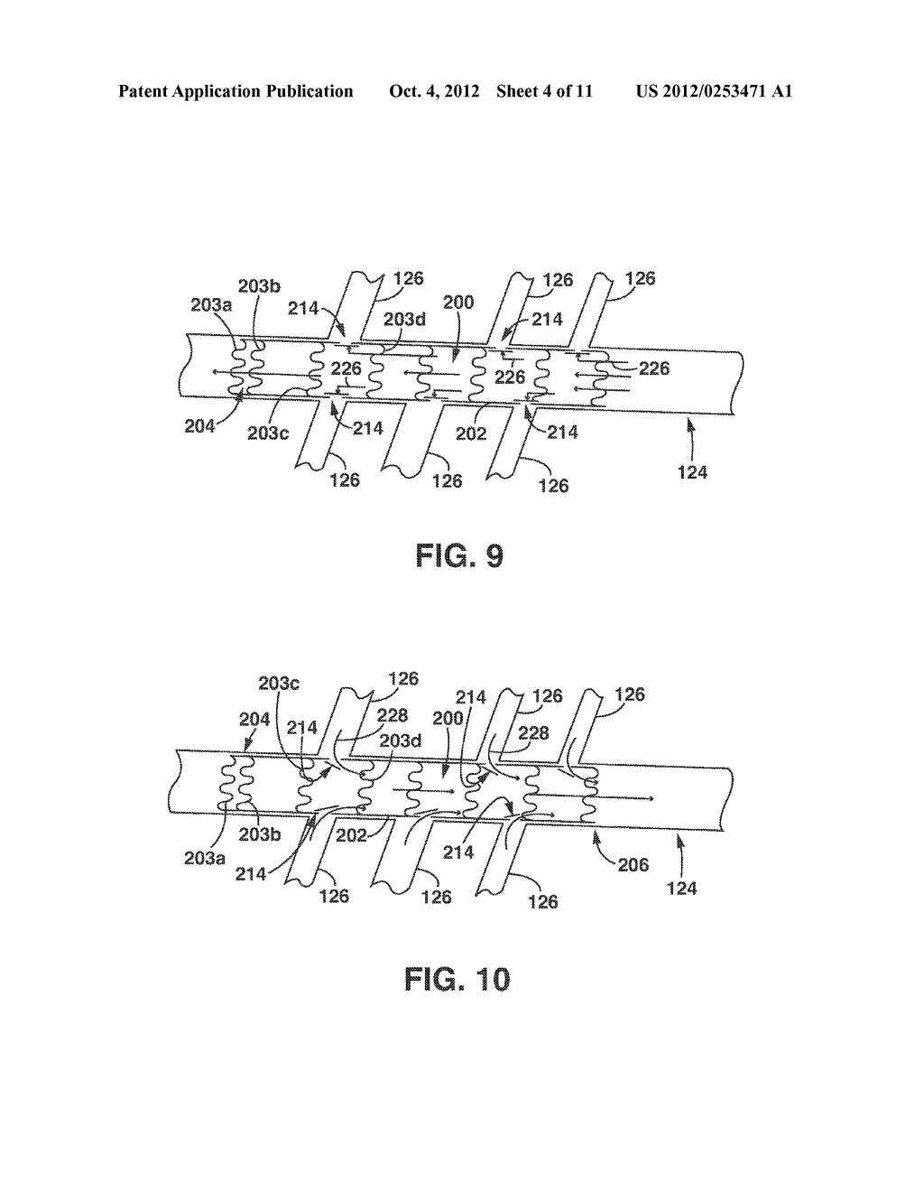 Variable Length Airway Stent Graft With One-Way Valves - diagram, schematic, and image 05