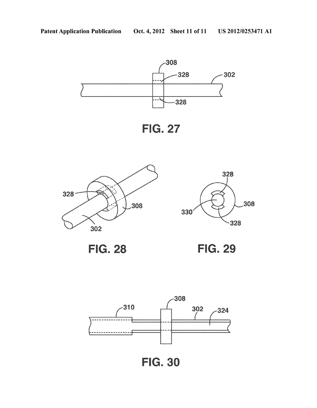 Variable Length Airway Stent Graft With One-Way Valves - diagram, schematic, and image 12