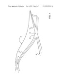 Data mining in a digital map database to identify intersections located at     hill bottoms and enabling precautionary actions in a vehicle diagram and image