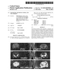 TRANSGENIC NON-HUMAN ANIMAL AND USES THEREOF diagram and image