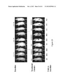 TRANSGENIC NON-HUMAN ANIMAL AND USES THEREOF diagram and image