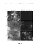 AGROBACTERIUM-MEDIATED TRANSFORMATION OF DICOT PLANTS diagram and image