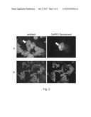 AGROBACTERIUM-MEDIATED TRANSFORMATION OF DICOT PLANTS diagram and image