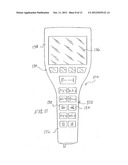 SURGERY TABLE HAVING COORDINATED MOTION diagram and image