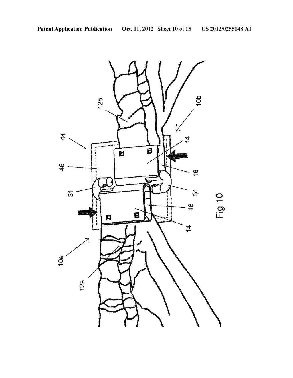 GARMENT CLIP - diagram, schematic, and image 11