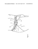 GARMENT CLIP diagram and image