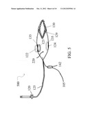 DEVISE FOR SNORING AND OBSTRUCTIVE SLEEP APNEA TREATMENT diagram and image