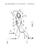 DEVISE FOR SNORING AND OBSTRUCTIVE SLEEP APNEA TREATMENT diagram and image