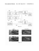 ANALYSIS OF 3D VIDEO diagram and image