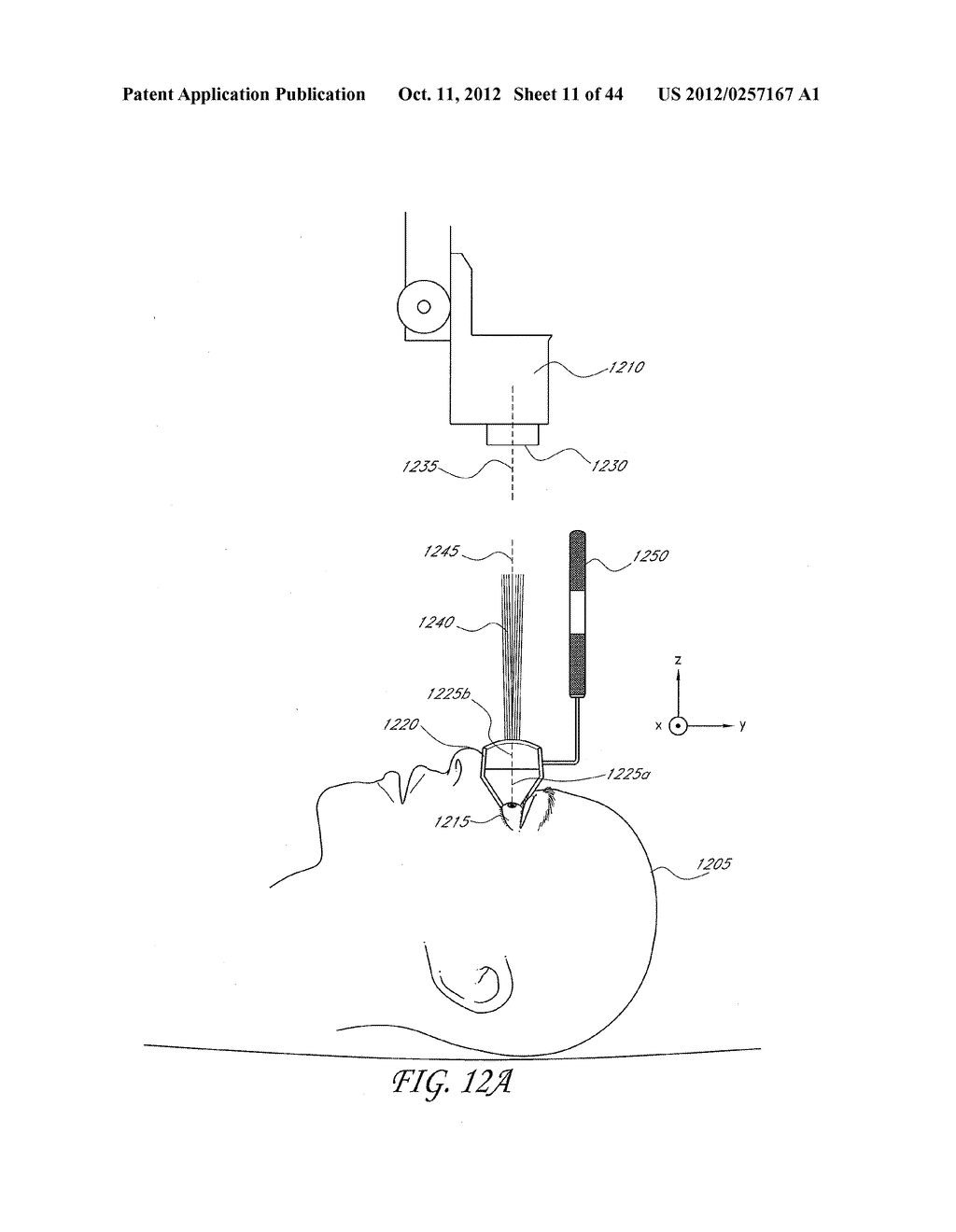 GONIOSCOPE FOR IMPROVED VIEWING - diagram, schematic, and image 12