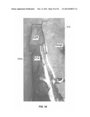 Hardfaced Wearpart Using Brazing And Associated Method And Assembly For     Manufacturing diagram and image