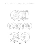 Portable Simultaneous Tooth Prophylaxis And Bleaching System diagram and image