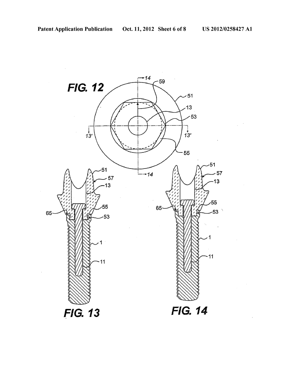 DENTAL ABUTMENT INCLUDING FILLET - diagram, schematic, and image 07