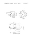 MODULATING LASER FOCAL LENGTH TO OPTIMIZE SURFACE TEXTURING ON MULTIPLE     SURFACES diagram and image