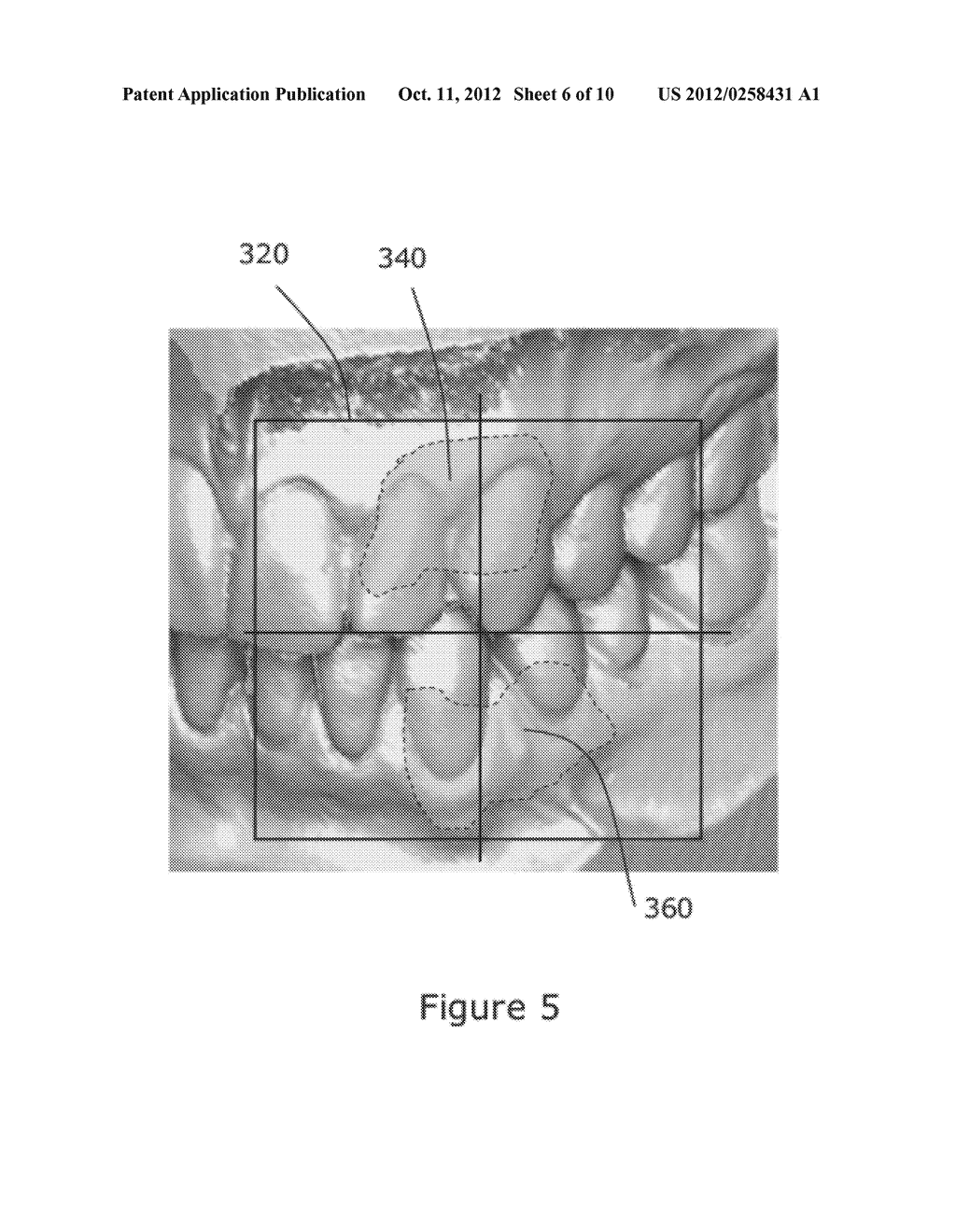 Method and System for Tracking Jaw Motion - diagram, schematic, and image 07