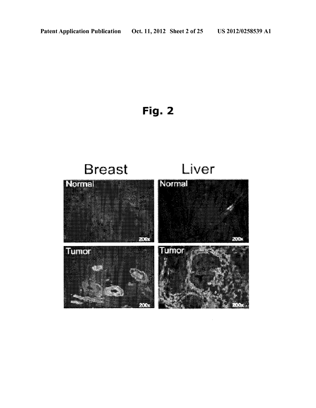 USE OF NIBP POLYPEPTIDES - diagram, schematic, and image 03