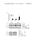 Targeting Estrogen Receptors in the Treatment of Lymphangioleiomyomatosis diagram and image