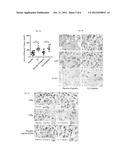 Targeting Estrogen Receptors in the Treatment of Lymphangioleiomyomatosis diagram and image