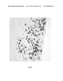 HUMAN PAPILLOMA VIRUS PROBES FOR THE DIAGNOSIS OF CANCER diagram and image