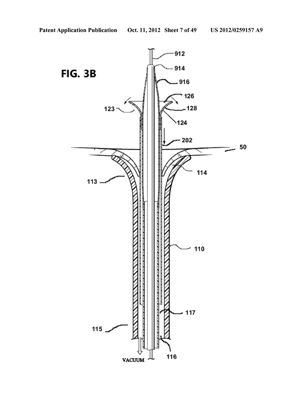 Cannula Systems and Methods - diagram, schematic, and image 08