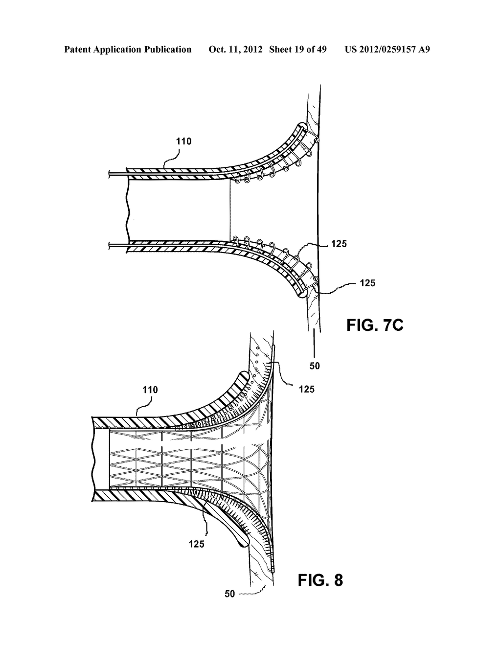 Cannula Systems and Methods - diagram, schematic, and image 20